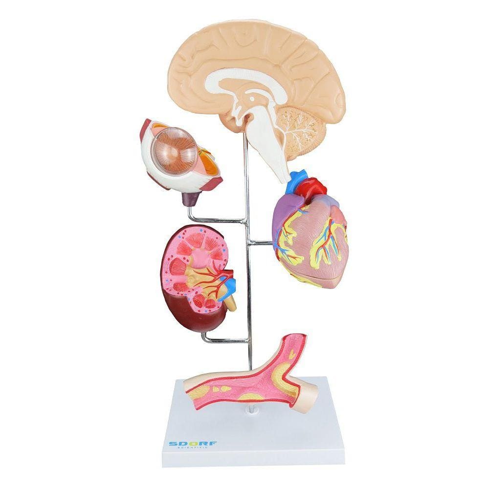 Órgãos afetados pela Hipertensão em 8 partes