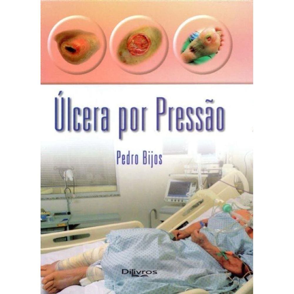 Livro  Ulcera Por Pressão