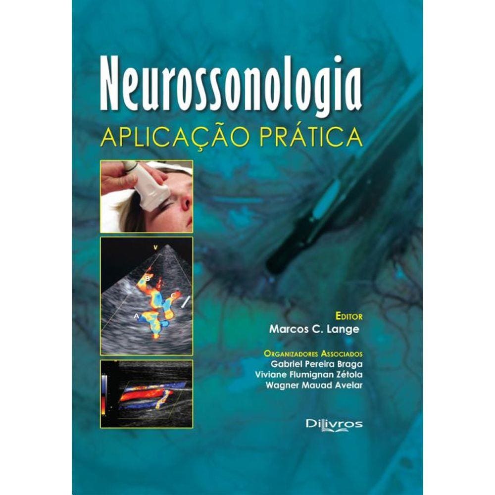 Neurossonologia Aplicação Pratica