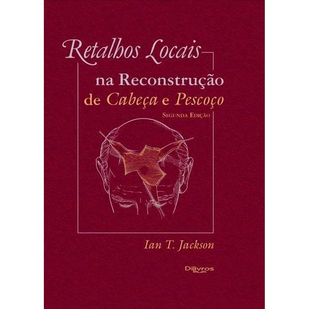 Retalhos Locais Na Reconstrucao De Cabeca E Pescoco