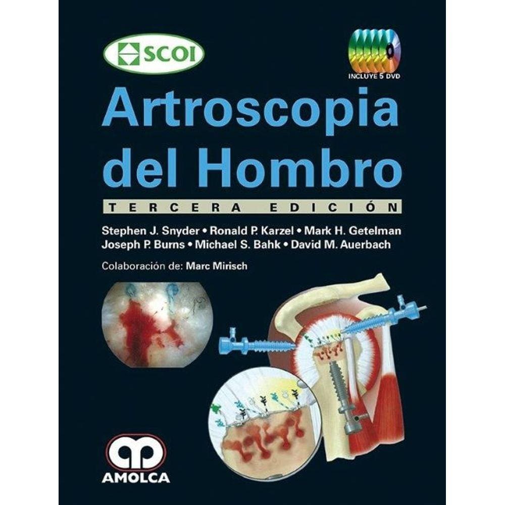 Scoi Artroscopia Del Hombro