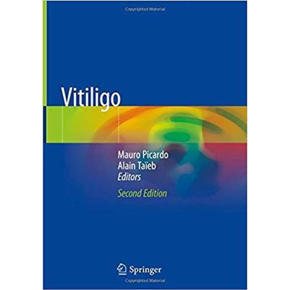 Vitiligo