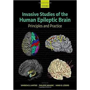 Invasive Studies Of The Human Epileptic Brain