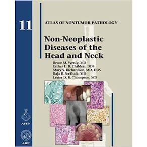 Non-neoplastic Diseases Of The Head And Neck