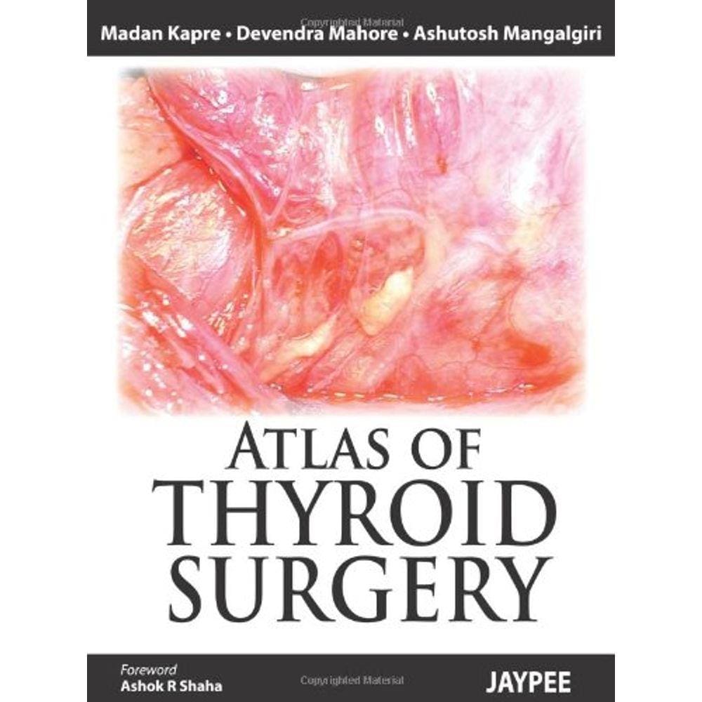 Atlas Of Thyroid Surgery