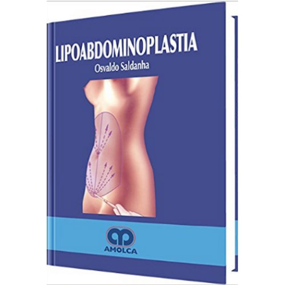 Lipoabdominioplastia (espanhol)