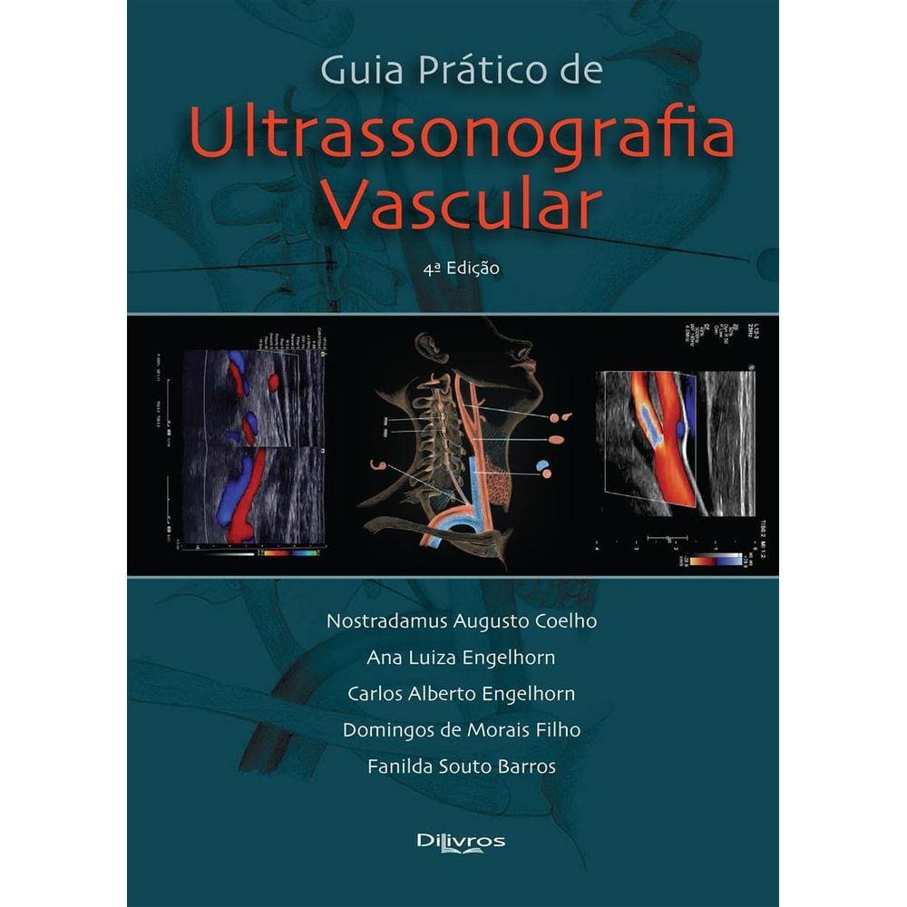 Guia Prático De Ultrassonografia Vascular