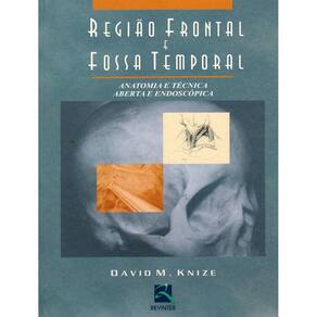 Regiao Frontal E Fossa Temporal Anatomia E Tecnica Aberta E Endoscopica