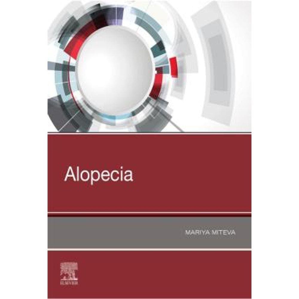 Alopecia