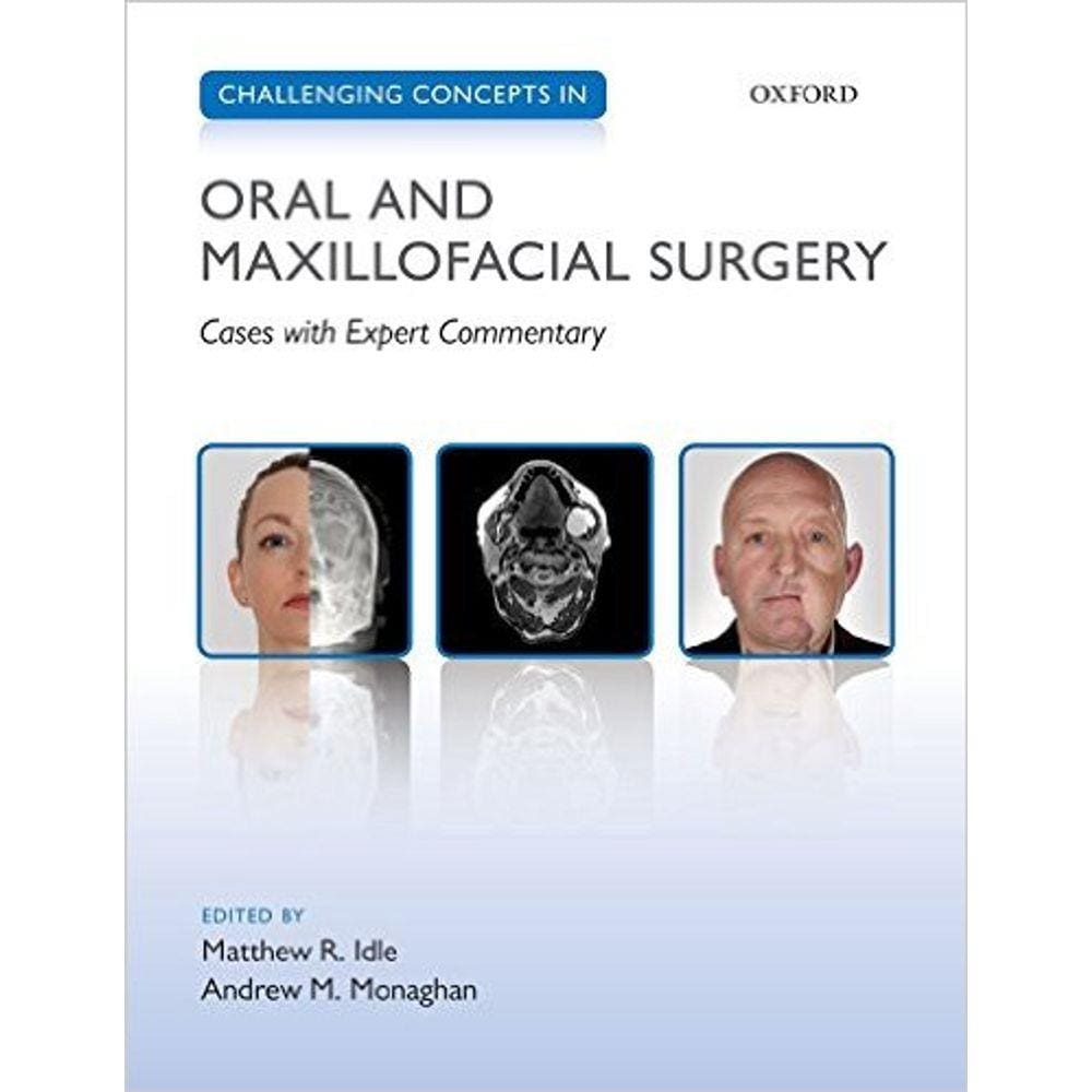 Challenging Concepts In Oral And Maxillofacial Surgery