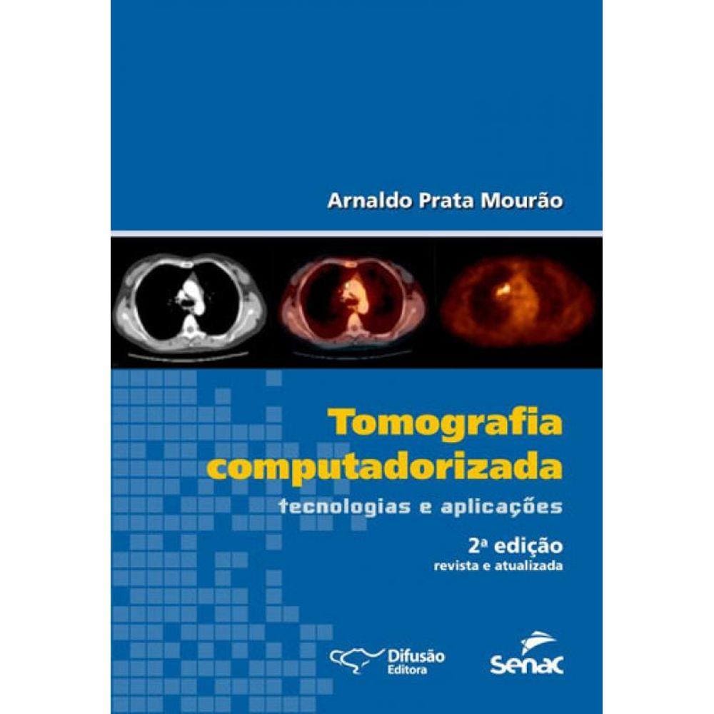 Tomografia Computadorizada