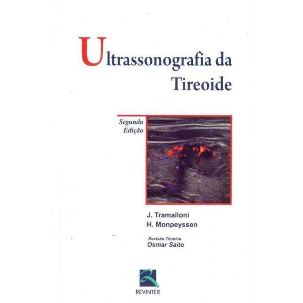 Ultrassonografia da Tireoide