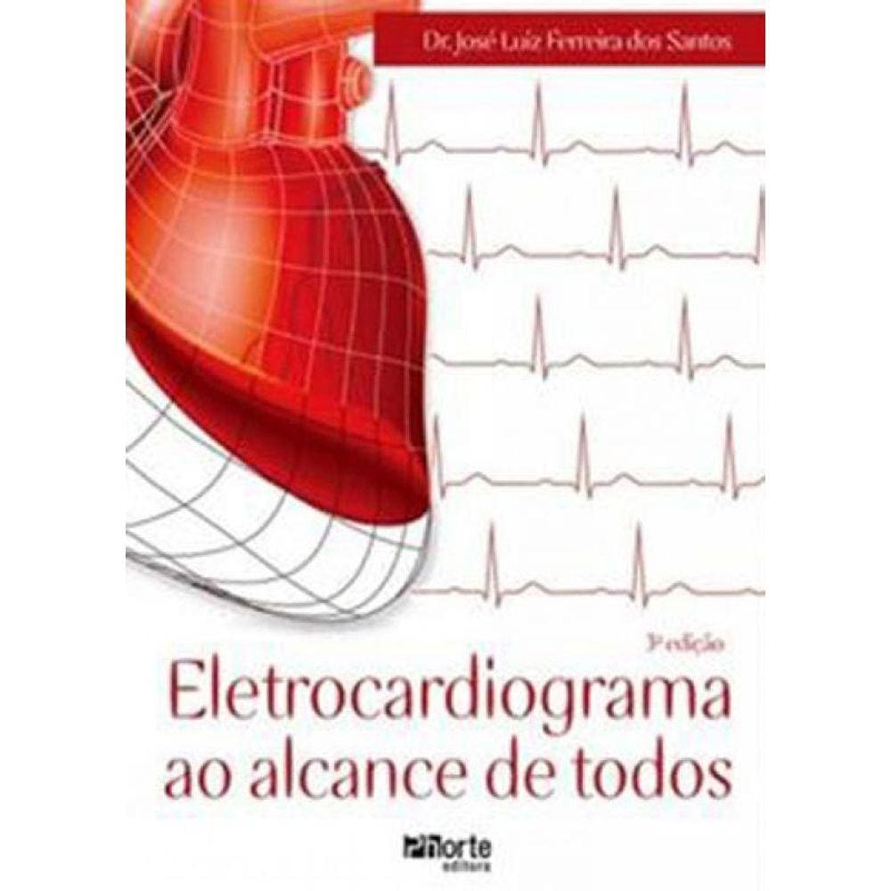 Eletrocardiograma Ao Alcance De Todos