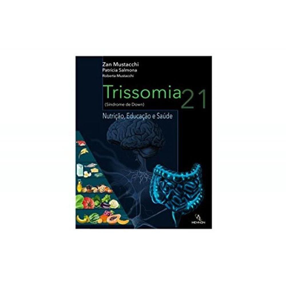 Trissomia 21 (Sindorme De Down)