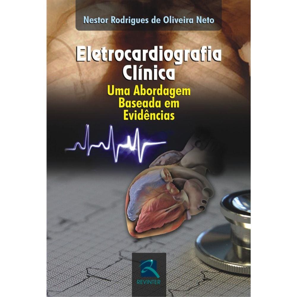 Eletrocardiografia Clínica