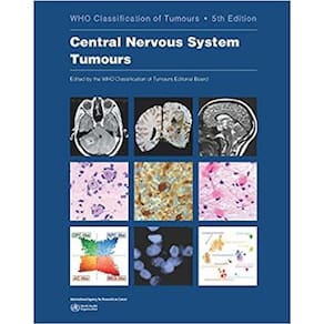 Central Nervous System Tumours