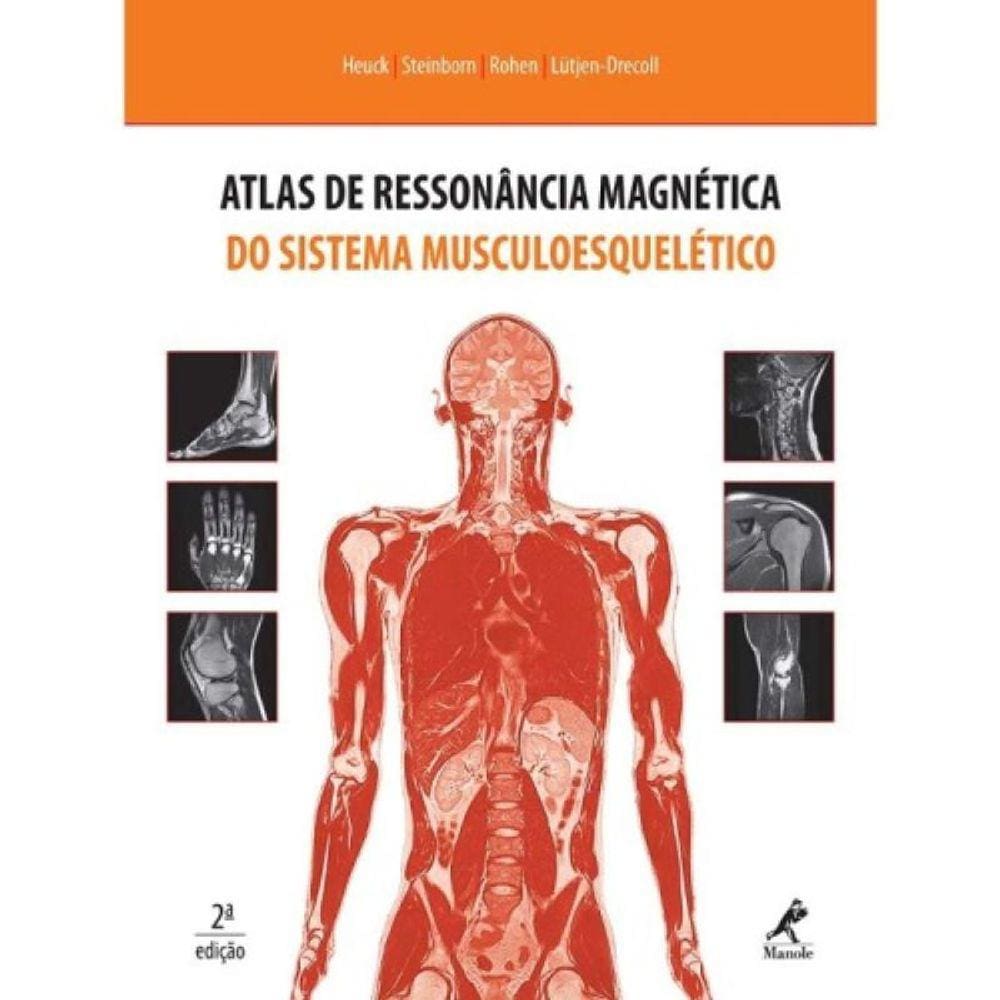 Atlas De Ressonância Magnética Do Sistema Musculoesquelético
