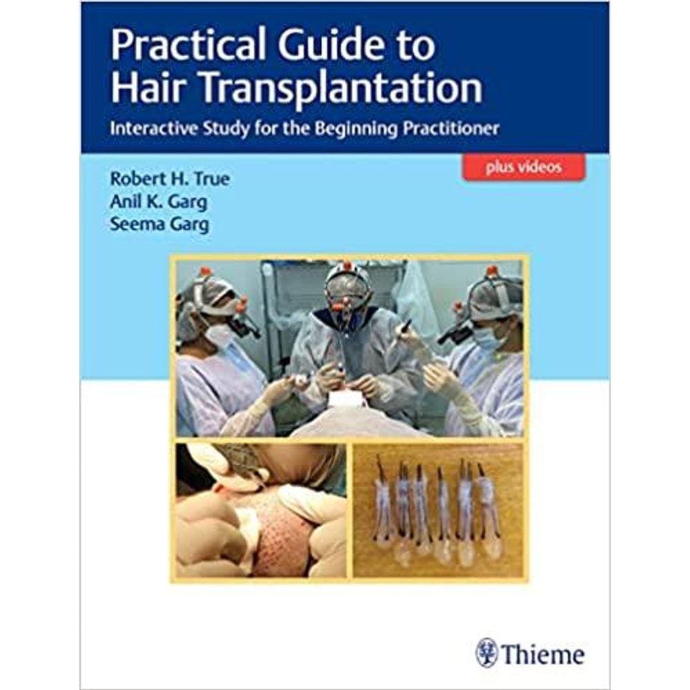 Practical Guide To Hair Transplantation