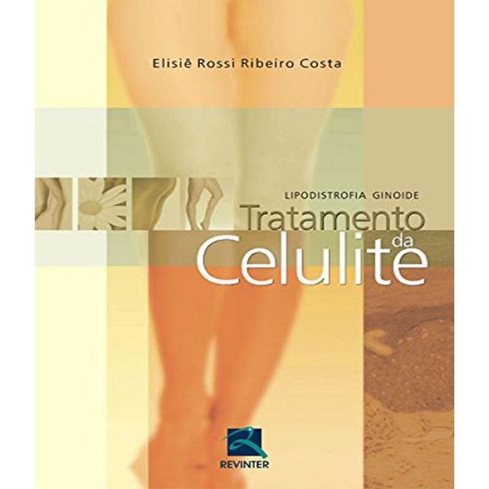 Livro Lipodistrofia Ginoide - Tratamento Da Celulite