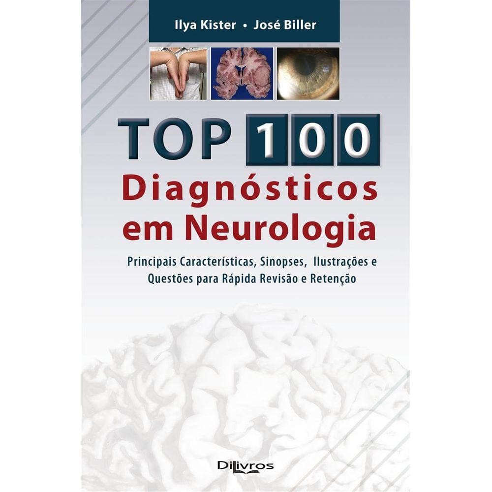 Top 100 nonude models Casas Bahia