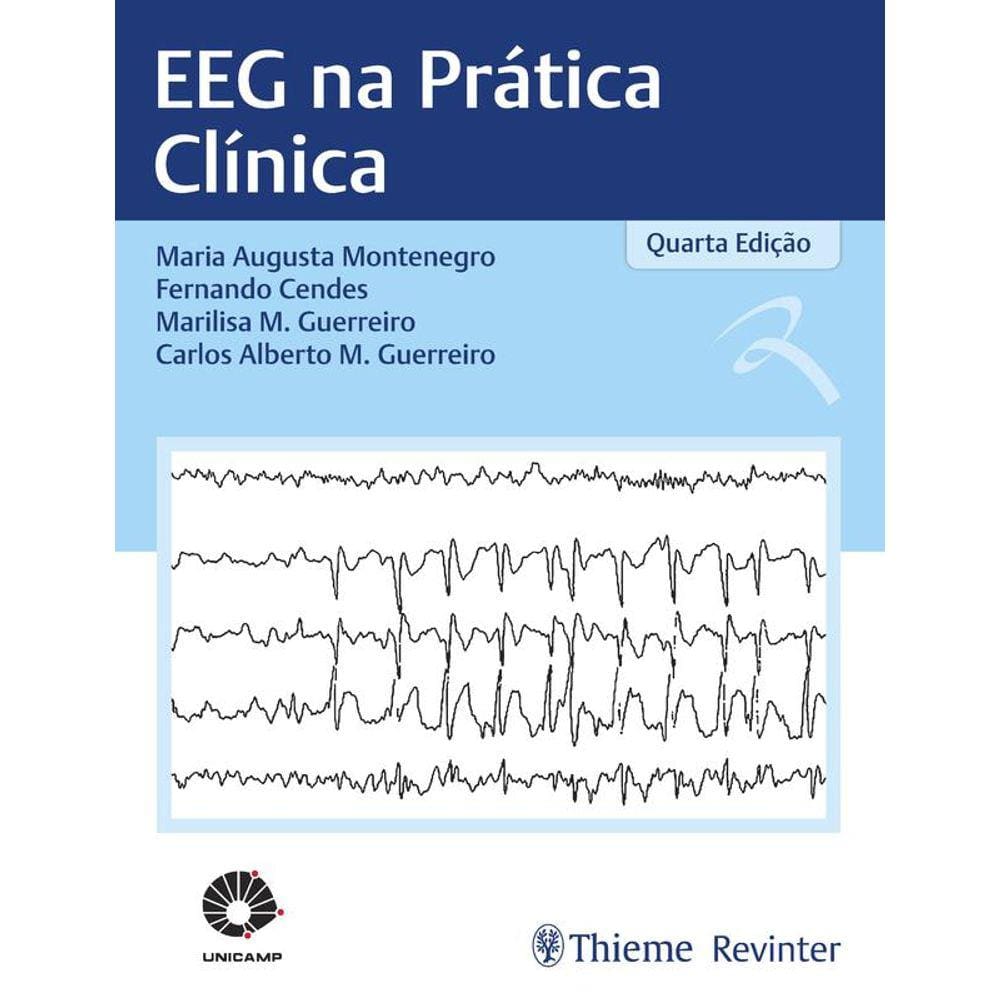 Eeg Na Pratica Clinica