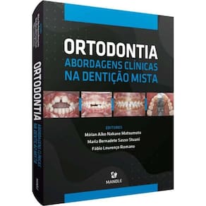 Ortodontia - Abordagens Clinicas Na Denticao Mista