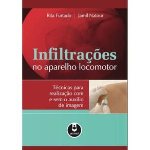 Infiltracoes No Aparelho Locomotor - Tecnicas Para Realizacao Com E Sem O A