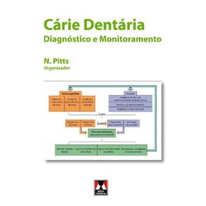 Cárie Dentária