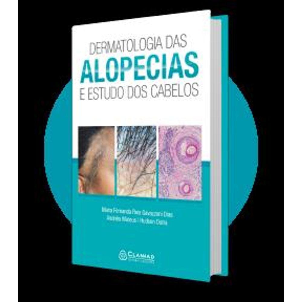 Dermatologia Das Alopecias e Estudo Dos Cabelos