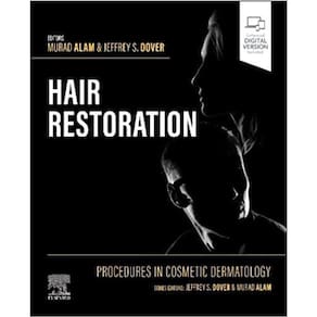 Procedures in Cosmetic Dermatology: Hair Restoration