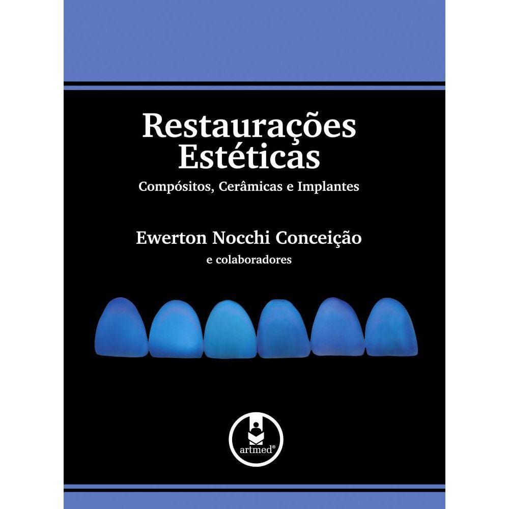 Restaurações Estéticas