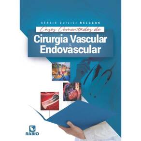 Casos Comentados De Cirurgia Vascular E Endovascul