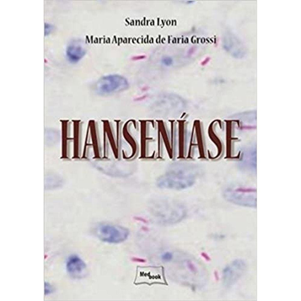 Hanseníase Capa dura – Edição padrão, 1 janeiro 2013