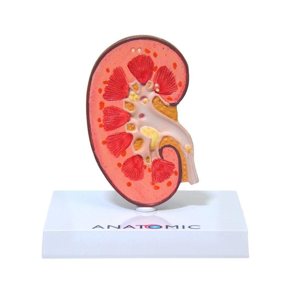 Rim Humano Com Patologias Em Corte Mediano