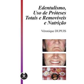 Edentulismo, Uso de Próteses Totais e Removíveis e Nutrição