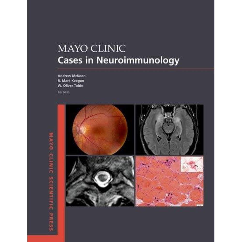 Mayo Clinic Cases In Neuroimmunology