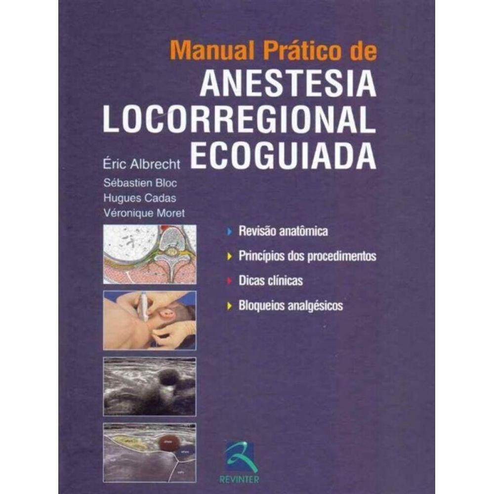 Manual Prático de Anestesia Locorregional Ecoguiada