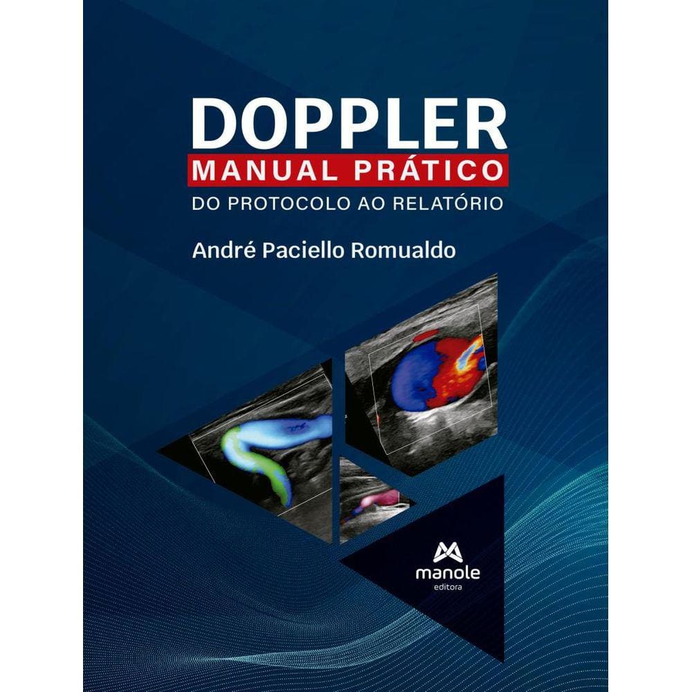 Doppler - Manual Pratico Do Protocolo Ao Relatorio