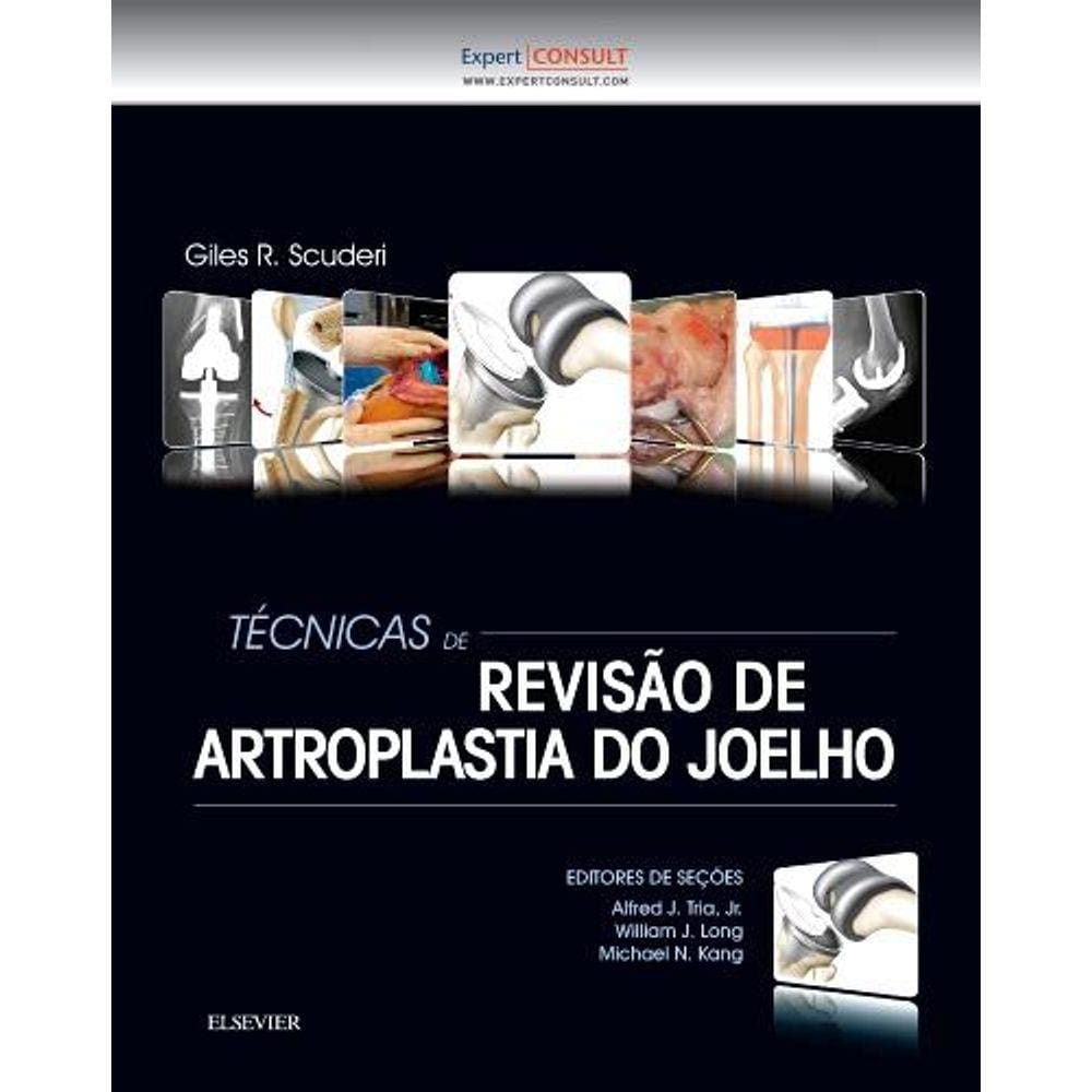 Tecnicas De Revisao De Artroplastia Do Joelho