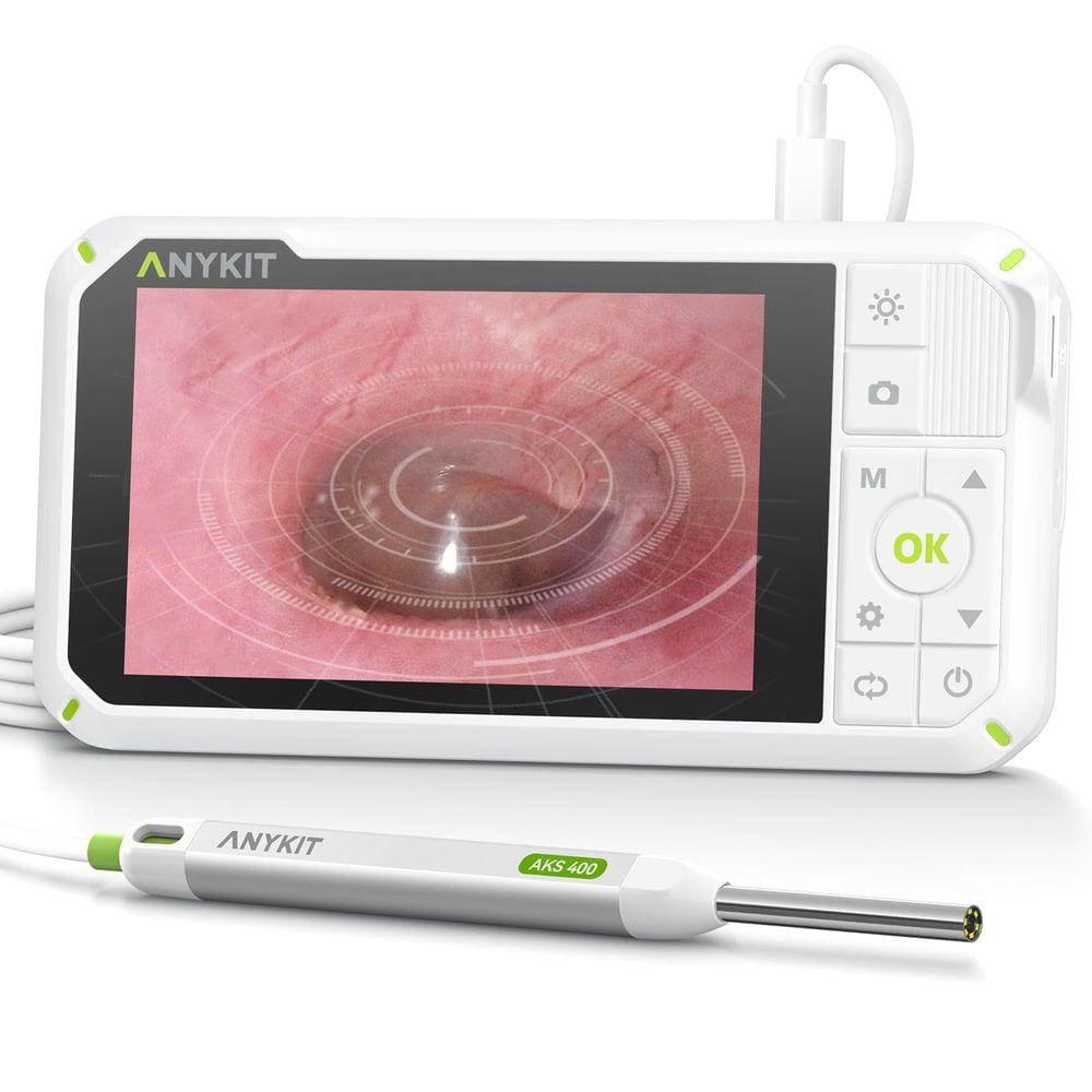 Otoscópio digital Anykit com giroscópio, tela IPS de 4 polegadas
