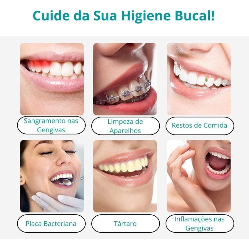 Irrigador Oral Jato Agua Higiene Bucal Limpeza Dental