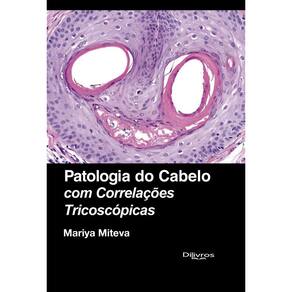 Patologia do Cabelo com Correlações Tricoscopias