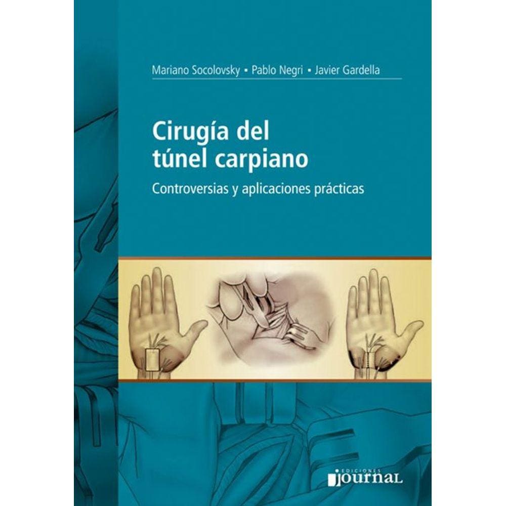 Cirugia Del Tunel Carpiano