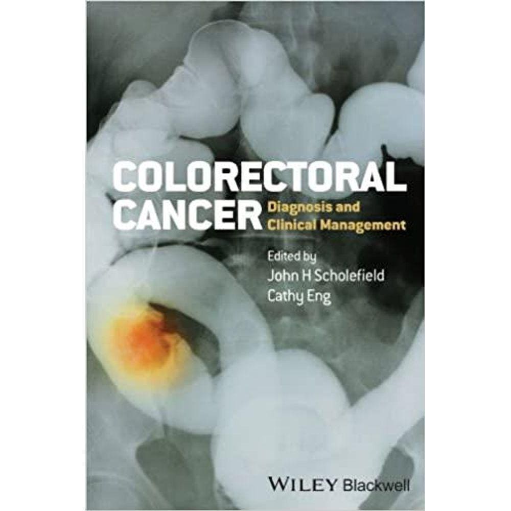 Colorectal Cancer: Diagnosis And Clinical Management