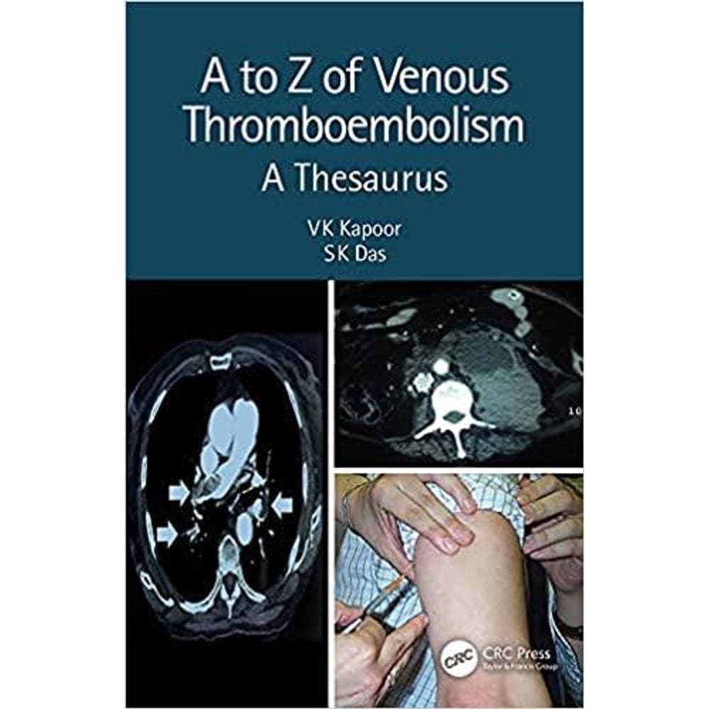 A To Z Of Venous Thromboembolism