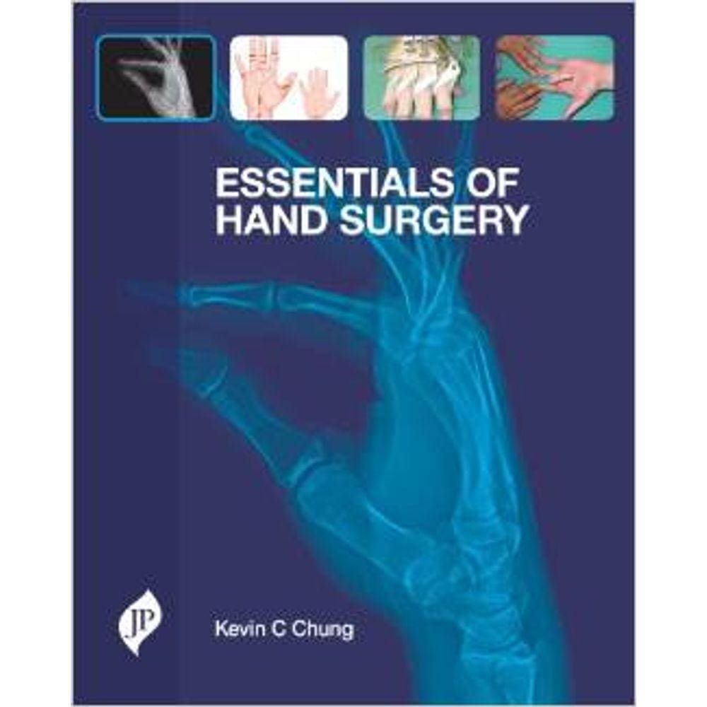 Essentials Of The Hand Surgery