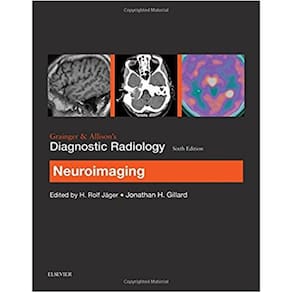 Grainger & Allison?S Diagnostic Radiology: Neuroimaging, 6Th Edition