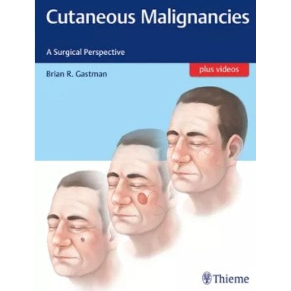 Cutaneous Malignancies