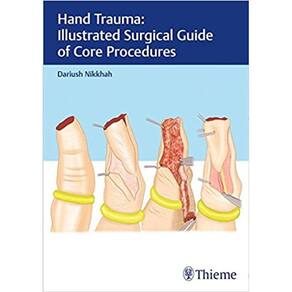 Hand Trauma: Illustrated Surgical Guide Of Core Procedures