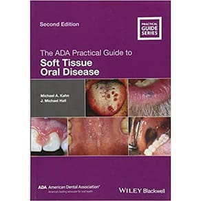 The Ada Practical Guide To Soft Tissue Oral Disease